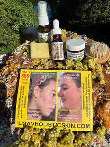 ACNE BUNDLE